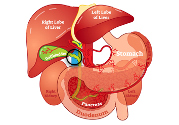 Bile duct disorders