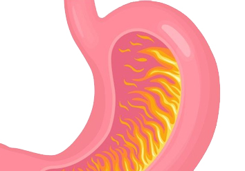 Heartburn 